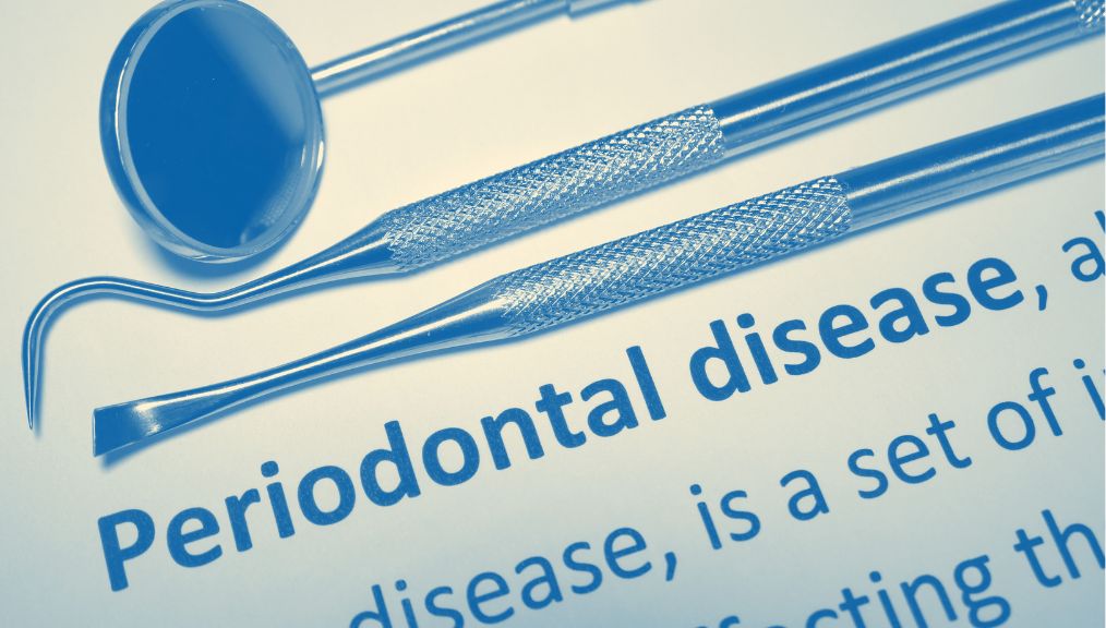 bleeding-gums-dentist-central-alberta