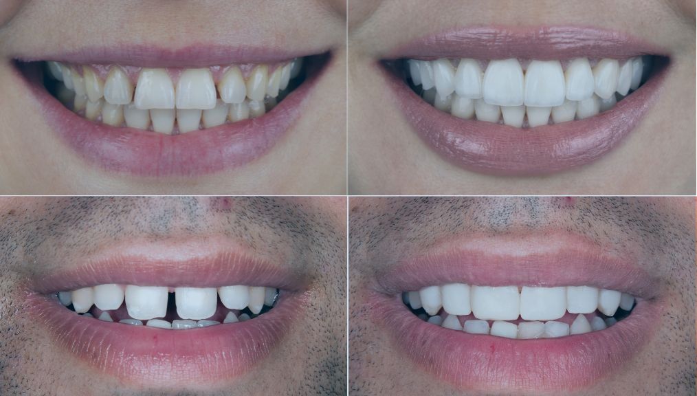 cosmetic-dentist-central-alberta