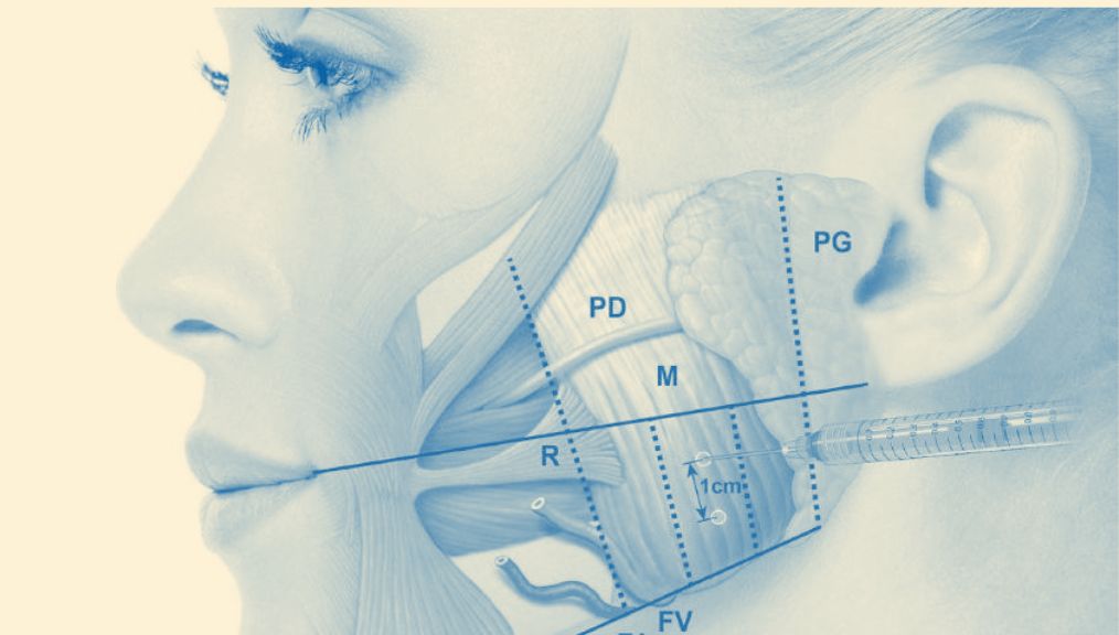 tmj-botox-treatment-central-alberta